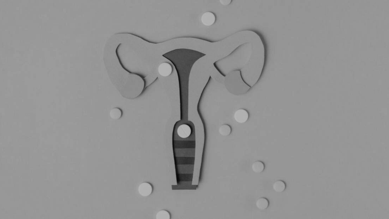 Cáncer cervicouterino: Principal causa de mortalidad en mujeres